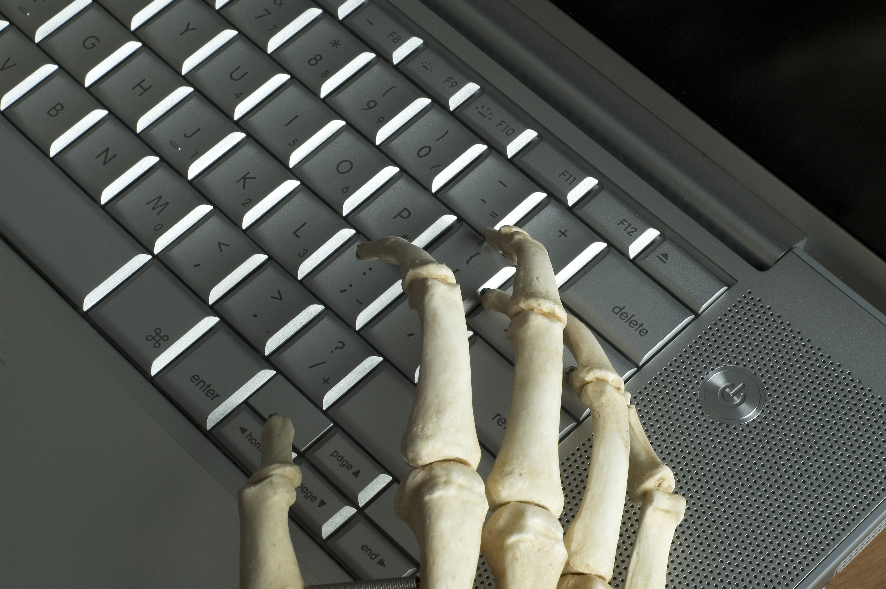 Skeletal hands